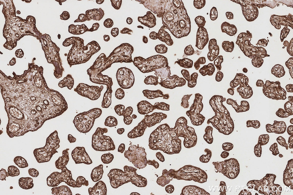 Immunohistochemistry (IHC) staining of human placenta tissue using TRIOBP Polyclonal antibody (16124-1-AP)