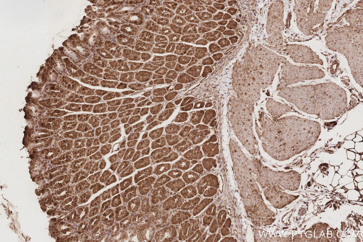 Immunohistochemistry (IHC) staining of mouse stomach tissue using TRIOBP Polyclonal antibody (16124-1-AP)