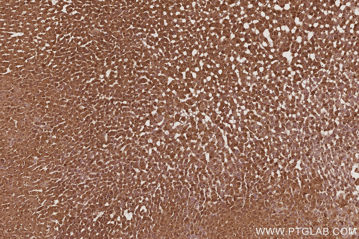 Immunohistochemistry (IHC) staining of rat adrenal gland tissue using TRIOBP Polyclonal antibody (16124-1-AP)