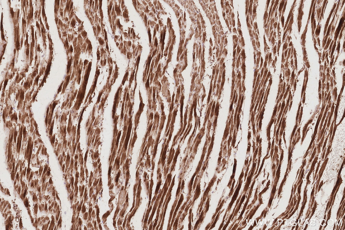 Immunohistochemistry (IHC) staining of rat heart tissue using TRIOBP Polyclonal antibody (16124-1-AP)
