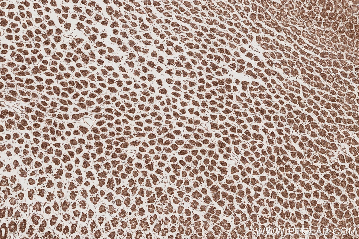 Immunohistochemistry (IHC) staining of rat stomach tissue using TRIOBP Polyclonal antibody (16124-1-AP)