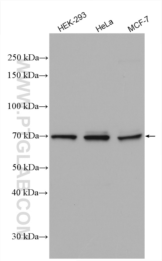 Western Blot (WB) analysis of various lysates using TRIOBP Polyclonal antibody (16124-1-AP)