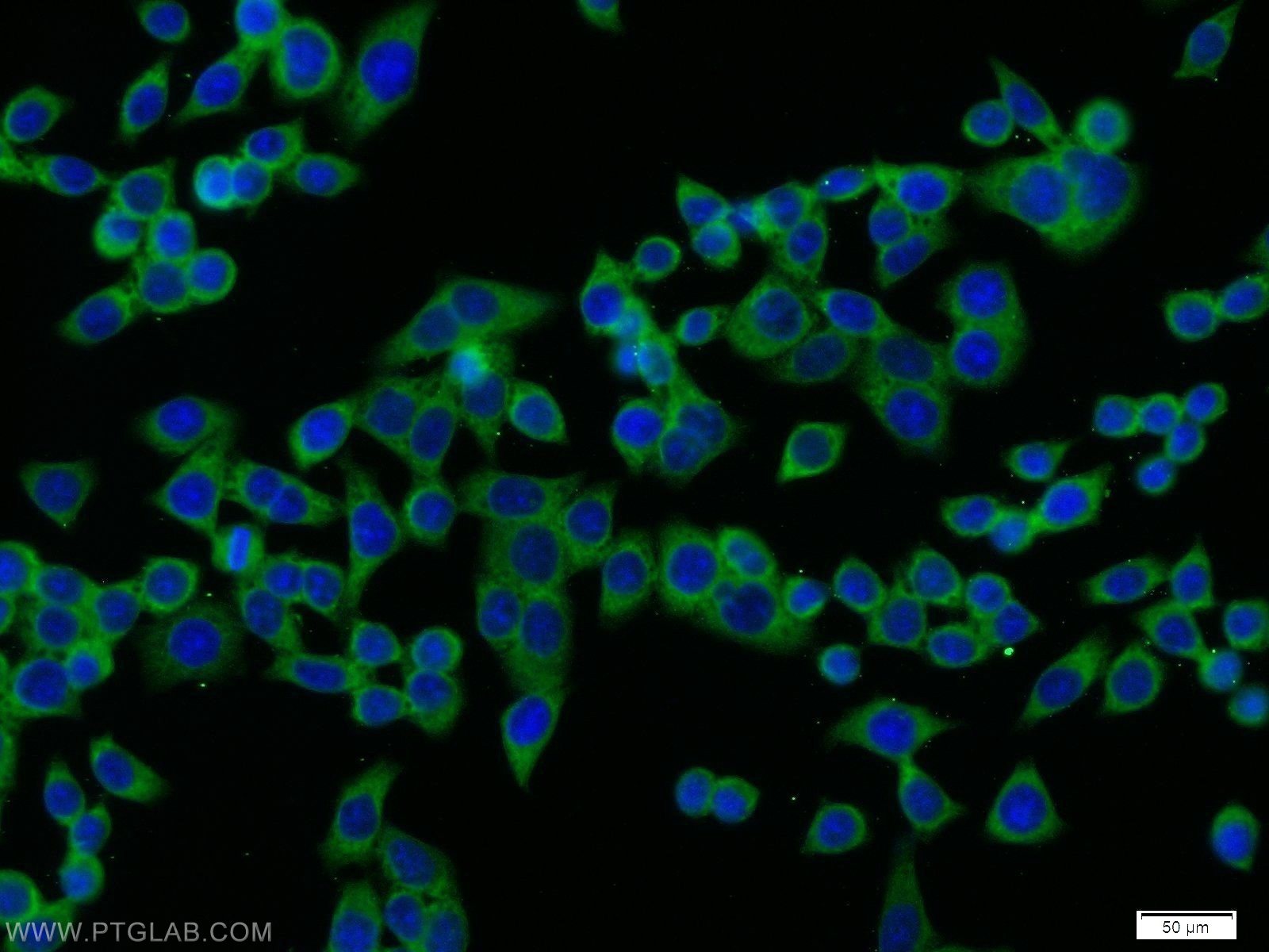 TRIP10 Polyclonal antibody