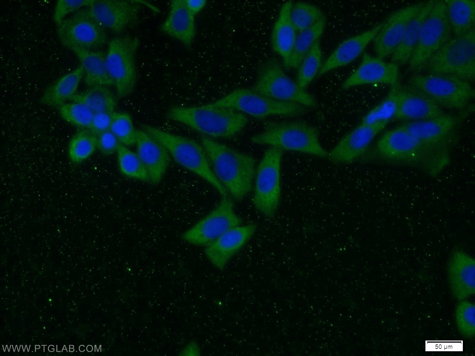 Immunofluorescence (IF) / fluorescent staining of HeLa cells using TRIP10 Polyclonal antibody (10798-1-AP)