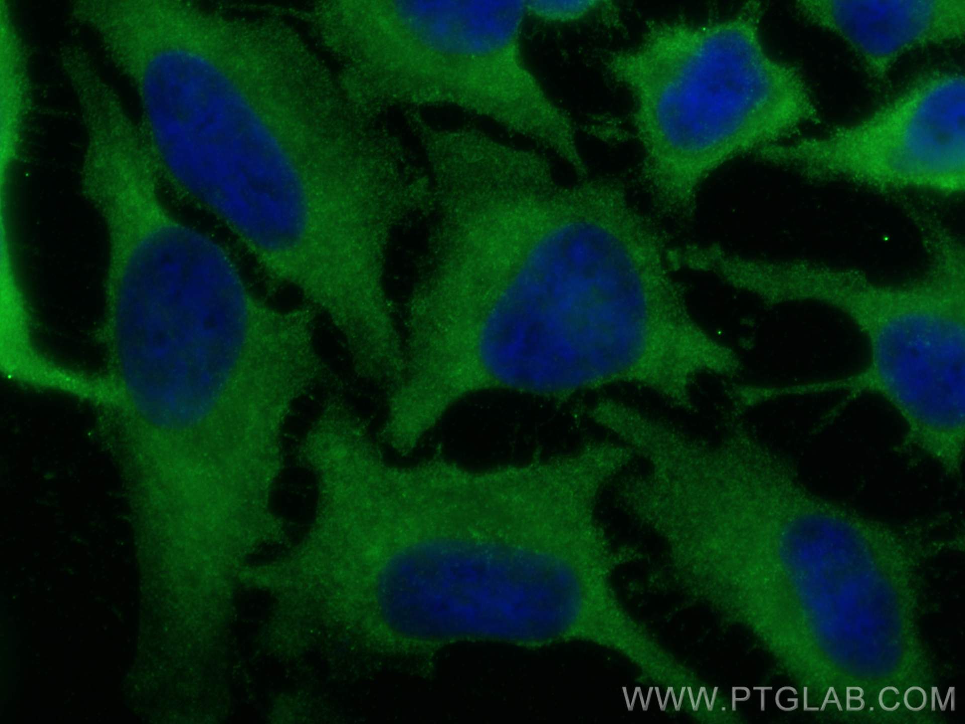 Immunofluorescence (IF) / fluorescent staining of HeLa cells using TRIP10 Polyclonal antibody (10798-1-AP)