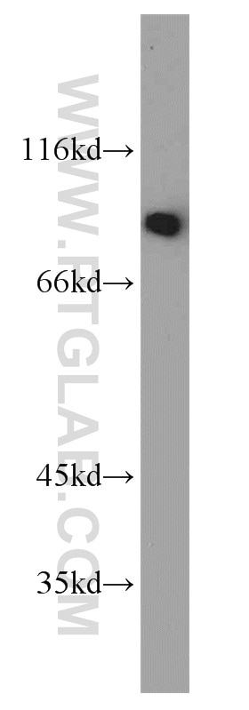 Western Blot (WB) analysis of K-562 cells using TRIP10 Polyclonal antibody (10798-1-AP)