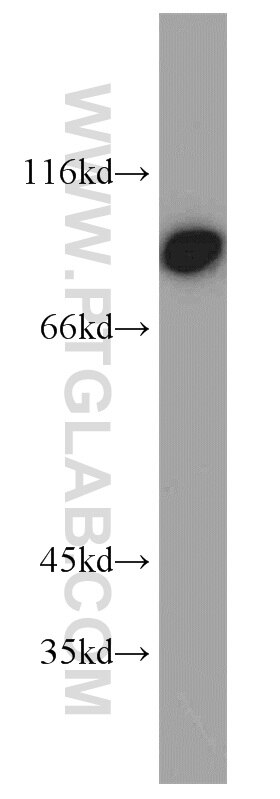 Western Blot (WB) analysis of BxPC-3 cells using TRIP10 Polyclonal antibody (10798-1-AP)