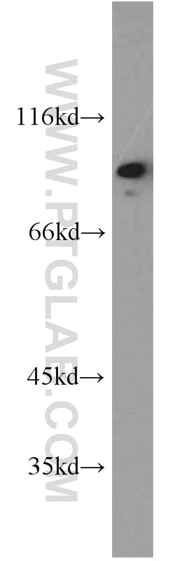 Western Blot (WB) analysis of mouse skeletal muscle tissue using TRIP10 Polyclonal antibody (10798-1-AP)