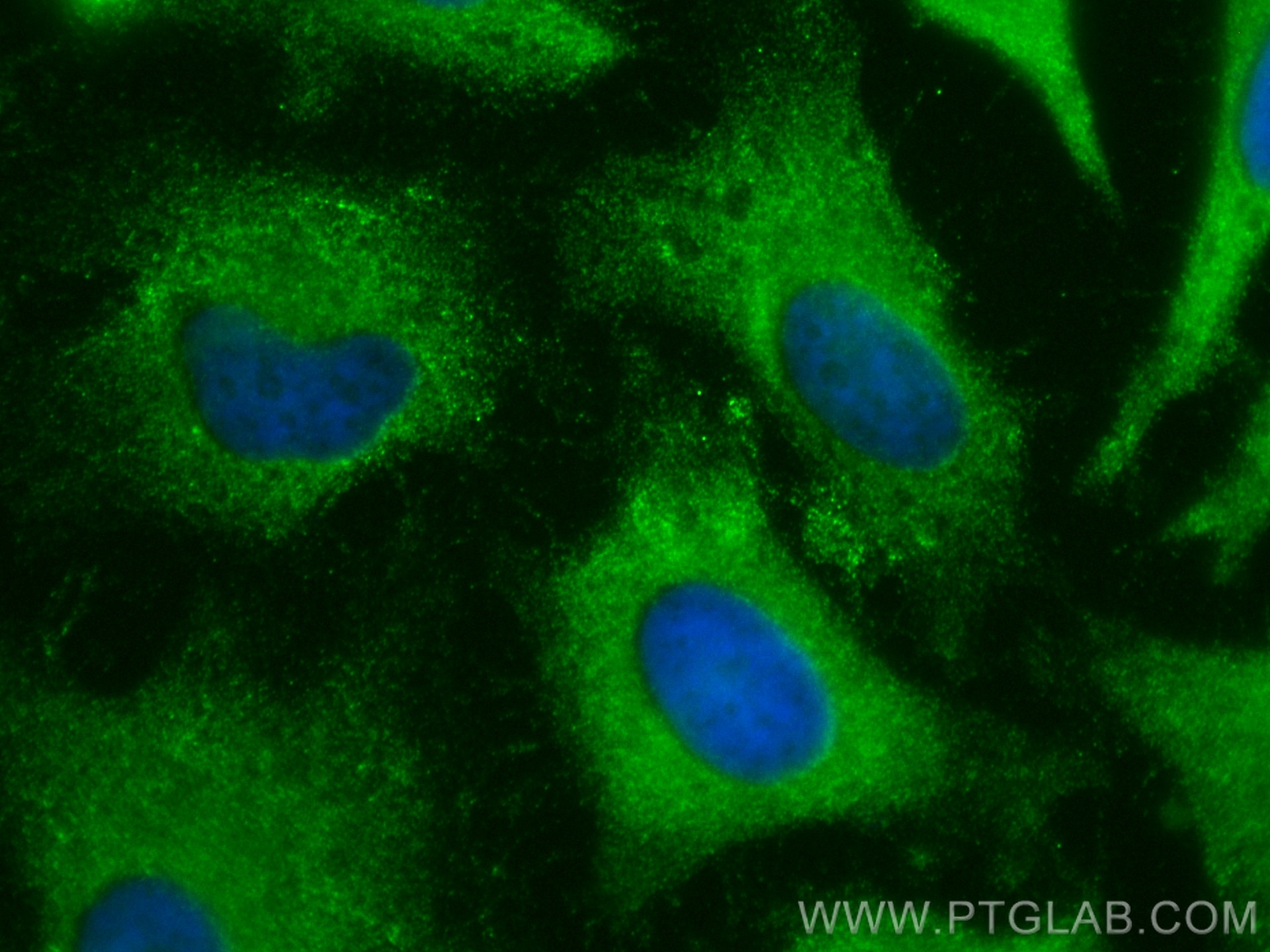 Immunofluorescence (IF) / fluorescent staining of HeLa cells using CoraLite® Plus 488-conjugated TRIP10 Polyclonal an (CL488-10798)