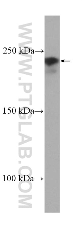 Western Blot (WB) analysis of MCF-7 cells using TRIP12 Polyclonal antibody (25303-1-AP)