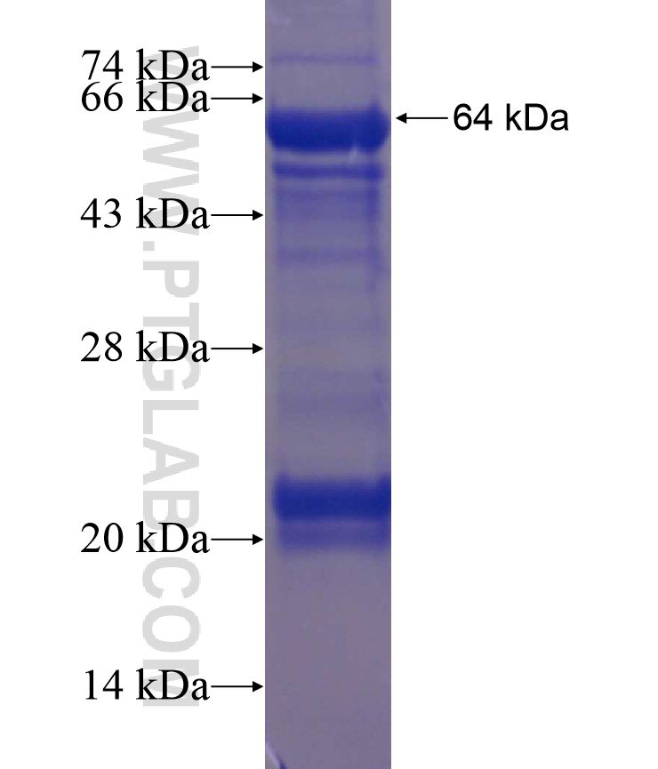 TRIP12 fusion protein Ag18112 SDS-PAGE