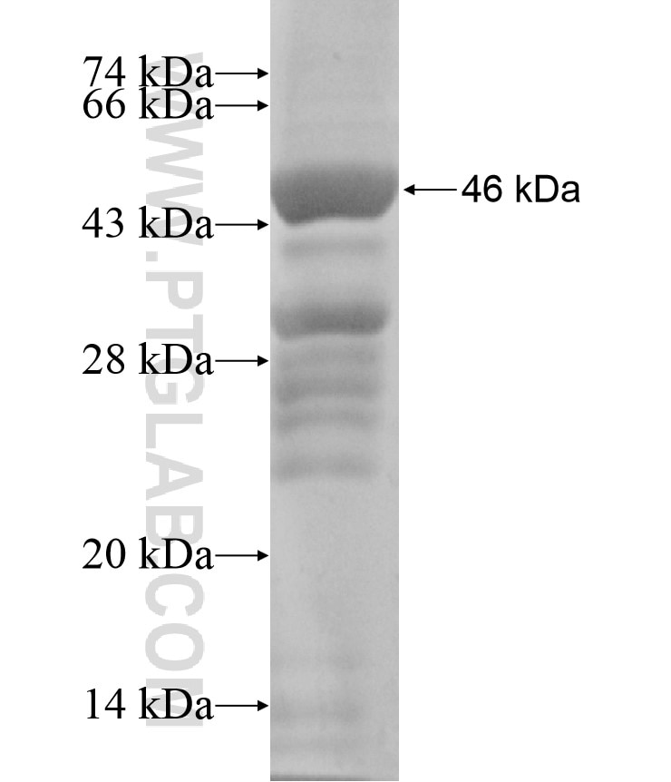 TRIP12 fusion protein Ag18155 SDS-PAGE