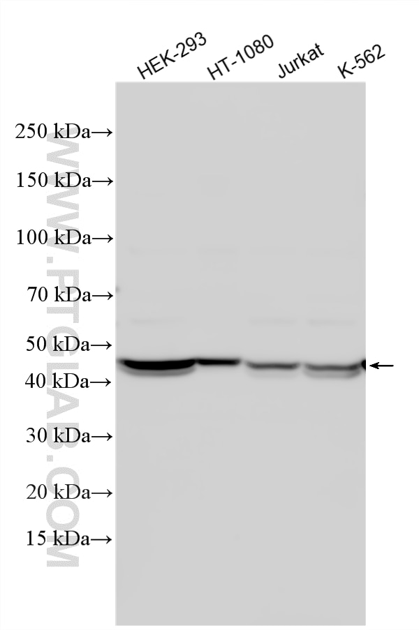 Western Blot (WB) analysis of various lysates using TRIP13 Polyclonal antibody (19602-1-AP)