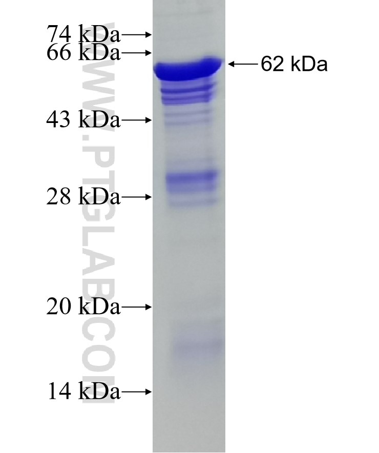 TRIP13 fusion protein Ag6508 SDS-PAGE