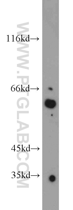 Western Blot (WB) analysis of HeLa cells using TRIP4 Polyclonal antibody (12324-1-AP)