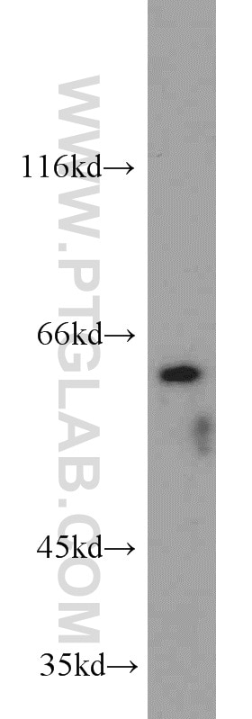 Western Blot (WB) analysis of COLO 320 cells using TRIP4 Polyclonal antibody (12324-1-AP)