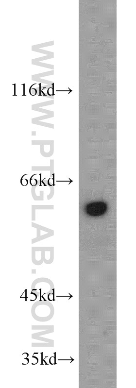 Western Blot (WB) analysis of HL-60 cells using TRIP4 Polyclonal antibody (12324-1-AP)