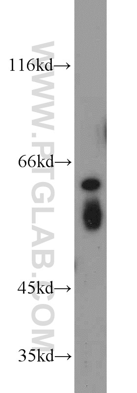 Western Blot (WB) analysis of HeLa cells using TRIP4 Polyclonal antibody (12324-1-AP)