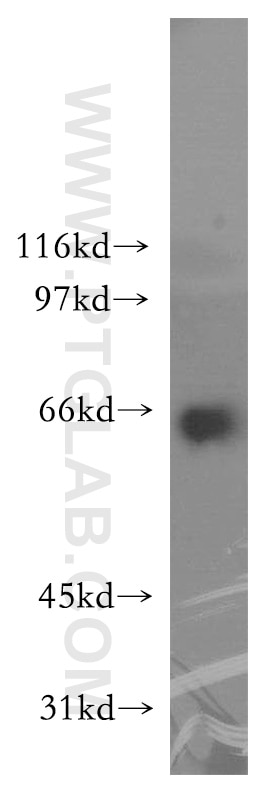 Western Blot (WB) analysis of HL-60 cells using TRIP4 Polyclonal antibody (12324-1-AP)