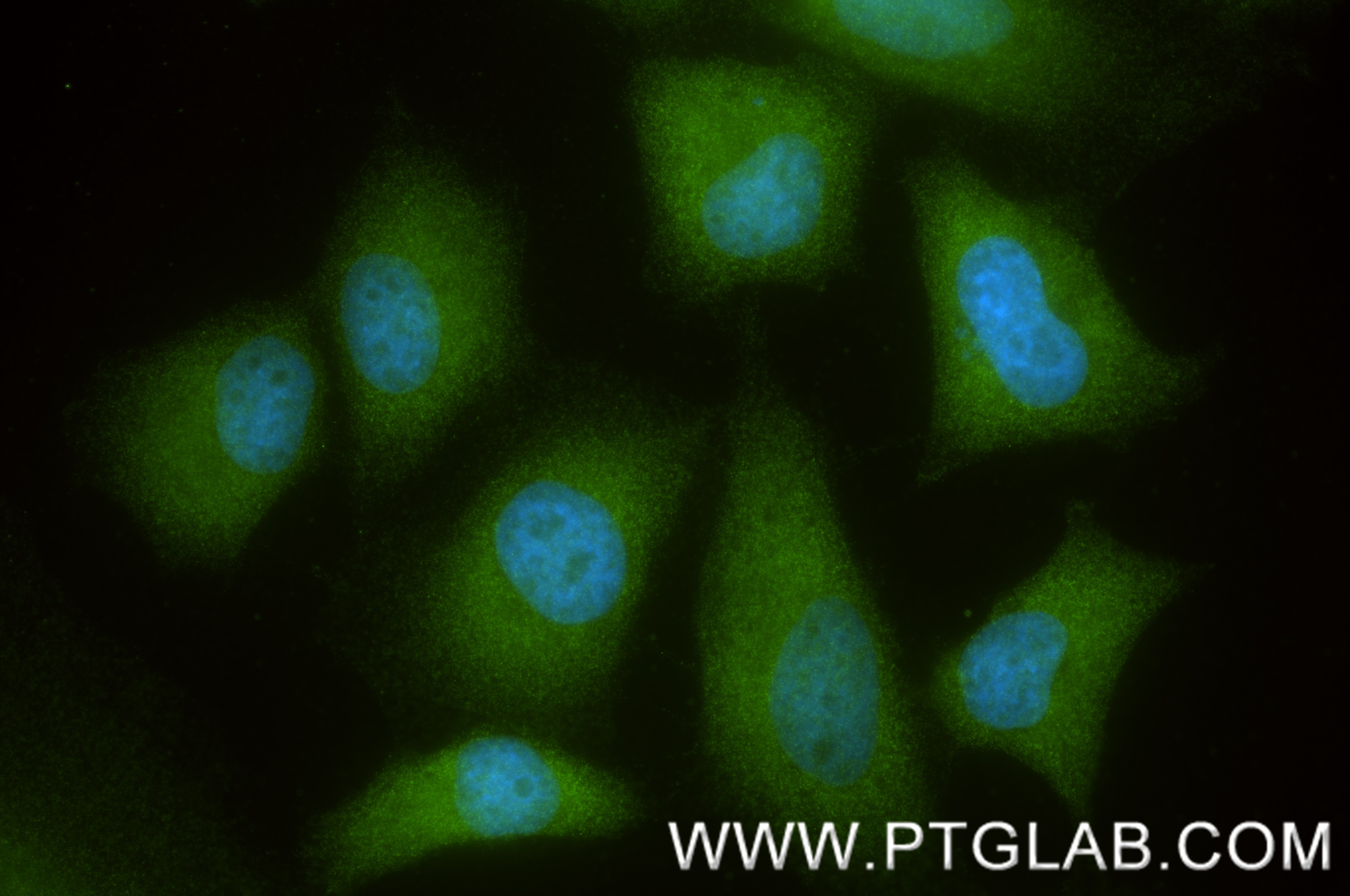 IF Staining of HeLa using 88025-1-RR Immunofluorescence (IF) / fluorescent staining of HeLa cells using TRIP4 Recombinant monoclonal antibody (88025-1-RR)