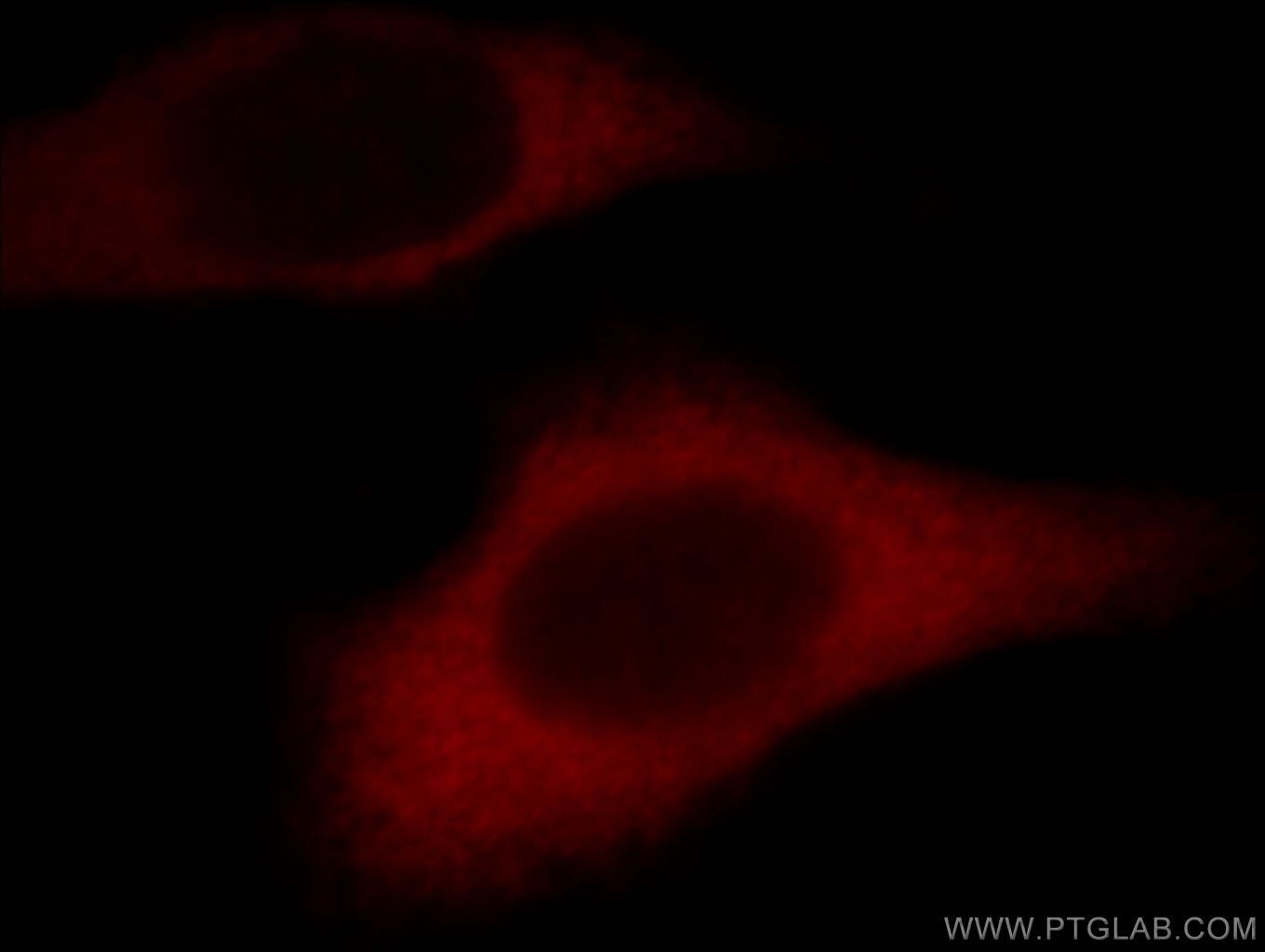 IF Staining of HepG2 using 21163-1-AP