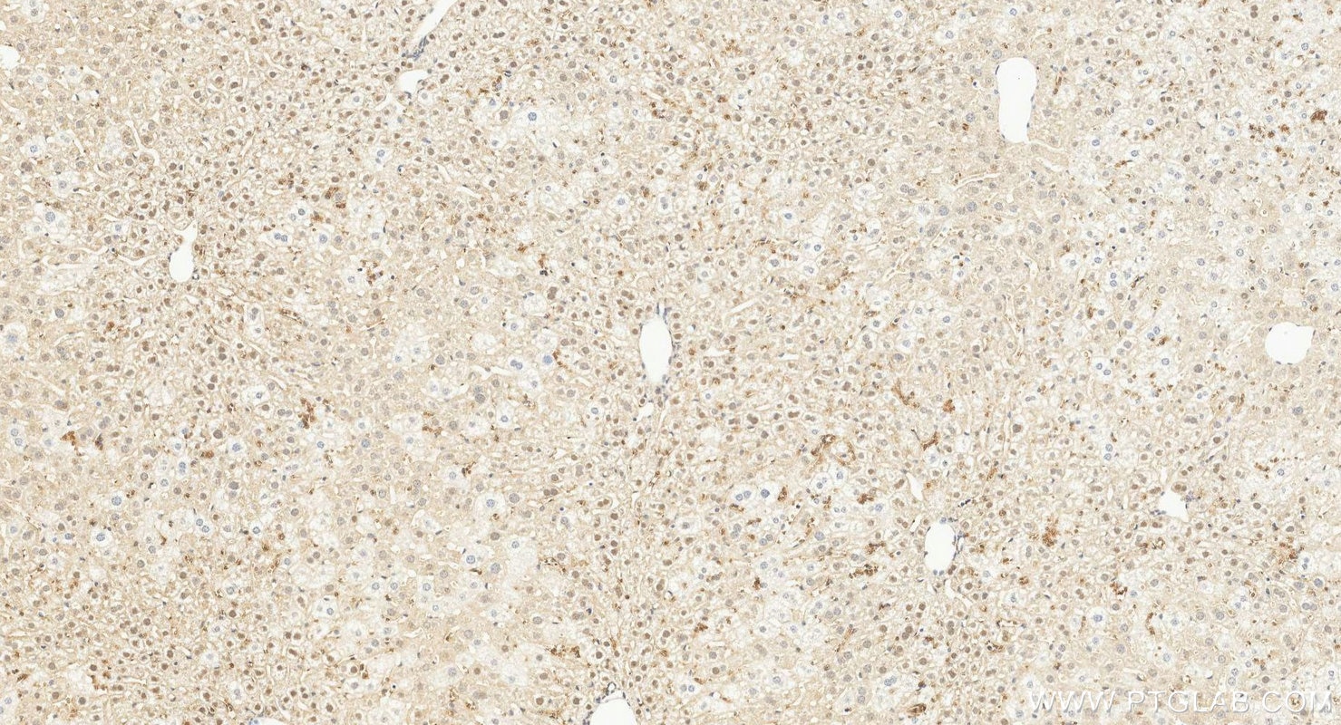Immunohistochemistry (IHC) staining of mouse liver tissue using TRIP6 Polyclonal antibody (21163-1-AP)