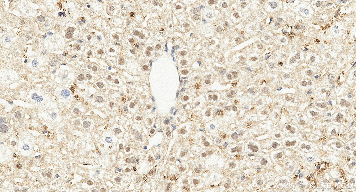 Immunohistochemistry (IHC) staining of mouse liver tissue using TRIP6 Polyclonal antibody (21163-1-AP)