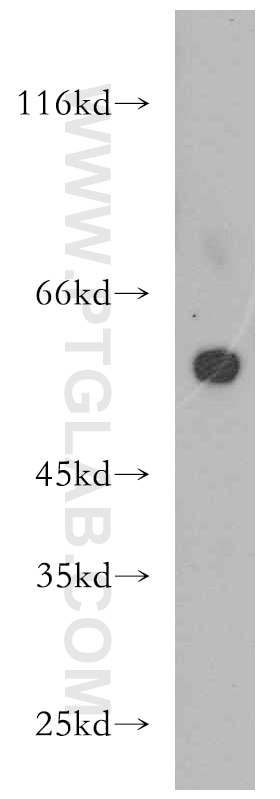Western Blot (WB) analysis of HepG2 cells using TRIP6 Polyclonal antibody (21163-1-AP)