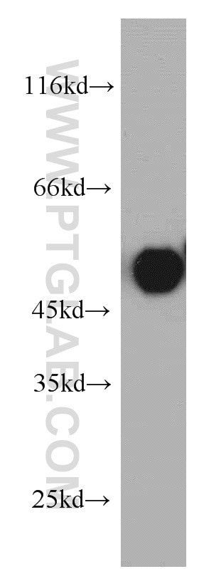 Western Blot (WB) analysis of HeLa cells using TRIP6 Polyclonal antibody (21163-1-AP)