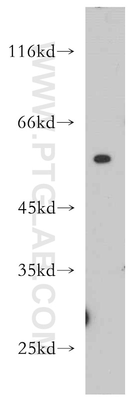 Western Blot (WB) analysis of mouse lung tissue using TRIP6 Polyclonal antibody (21163-1-AP)