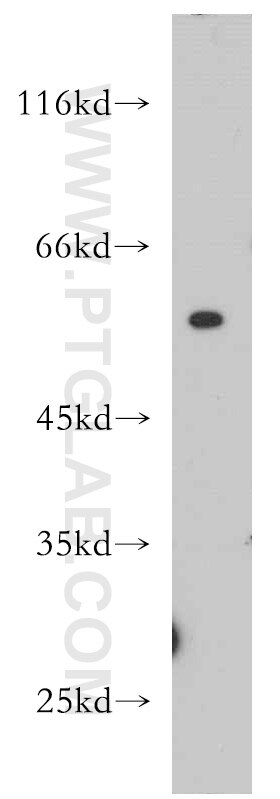 WB analysis of mouse lung using 21163-1-AP