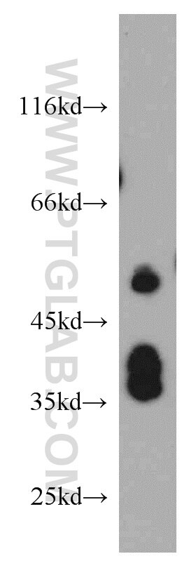 Western Blot (WB) analysis of human testis tissue using TRIP6 Polyclonal antibody (21163-1-AP)