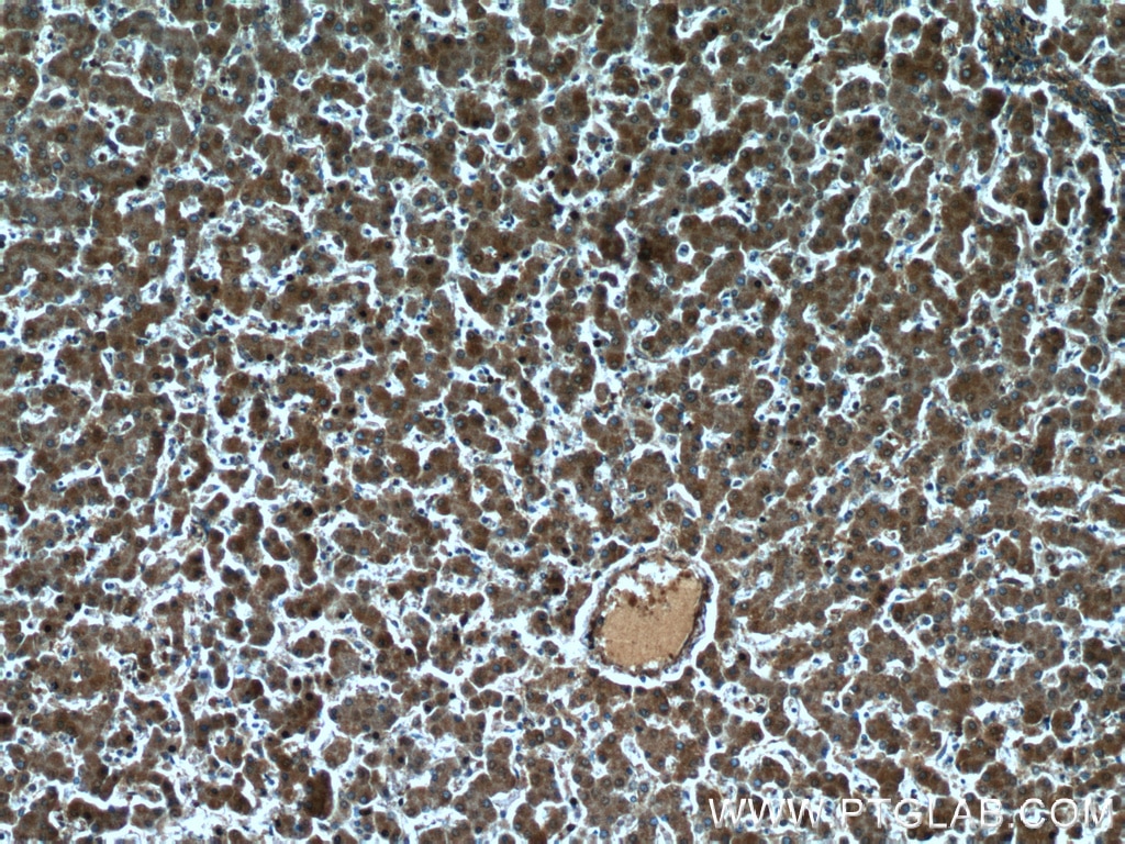 Immunohistochemistry (IHC) staining of human liver tissue using TRIP6 Monoclonal antibody (60205-1-Ig)
