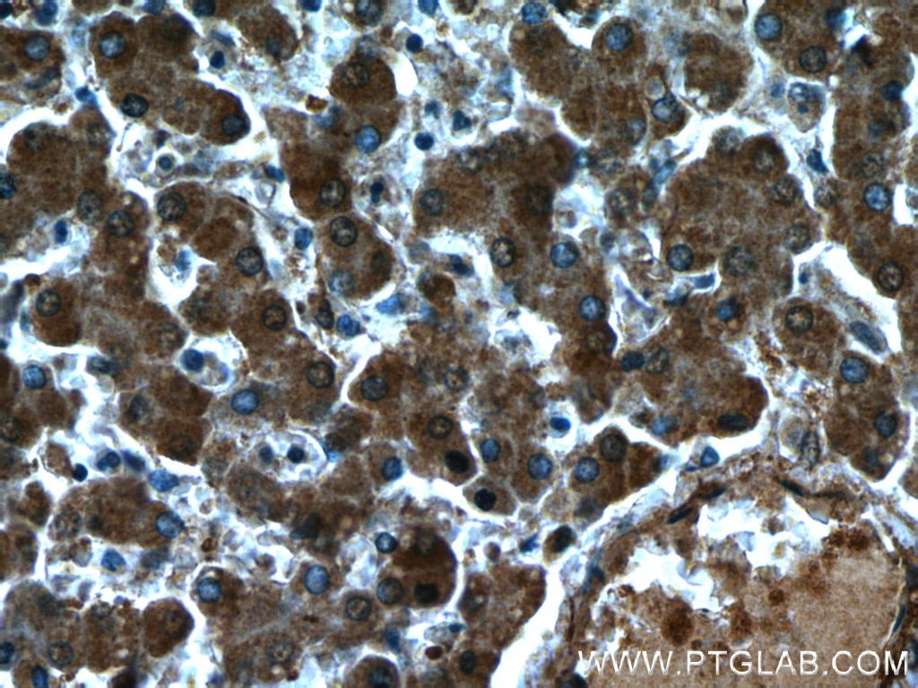 Immunohistochemistry (IHC) staining of human liver tissue using TRIP6 Monoclonal antibody (60205-1-Ig)