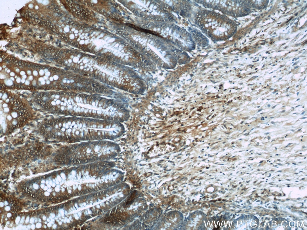 Immunohistochemistry (IHC) staining of human colon tissue using TRIP6 Monoclonal antibody (60205-1-Ig)