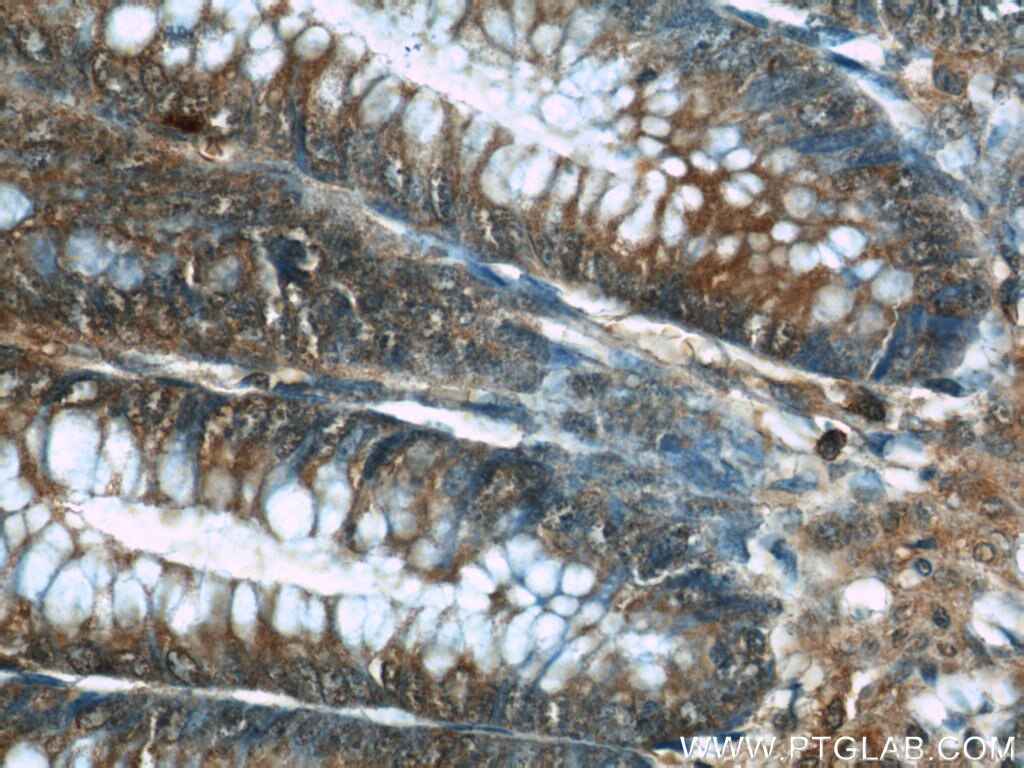 Immunohistochemistry (IHC) staining of human colon tissue using TRIP6 Monoclonal antibody (60205-1-Ig)