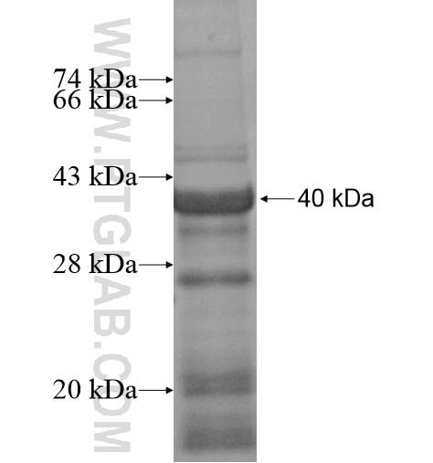 TRIP6 fusion protein Ag15149 SDS-PAGE
