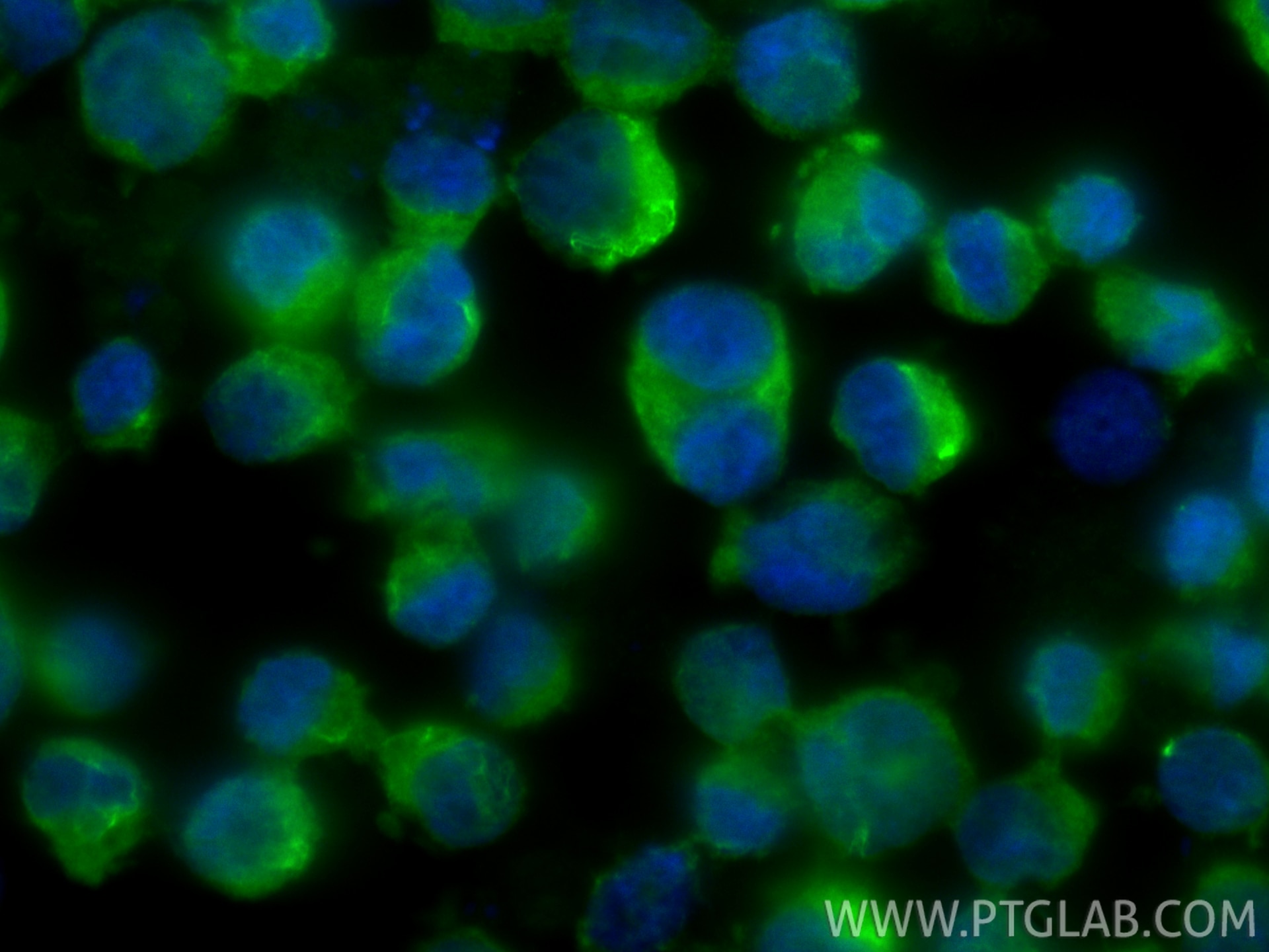 Immunofluorescence (IF) / fluorescent staining of K-562 cells using TRIT1 Polyclonal antibody (17141-1-AP)