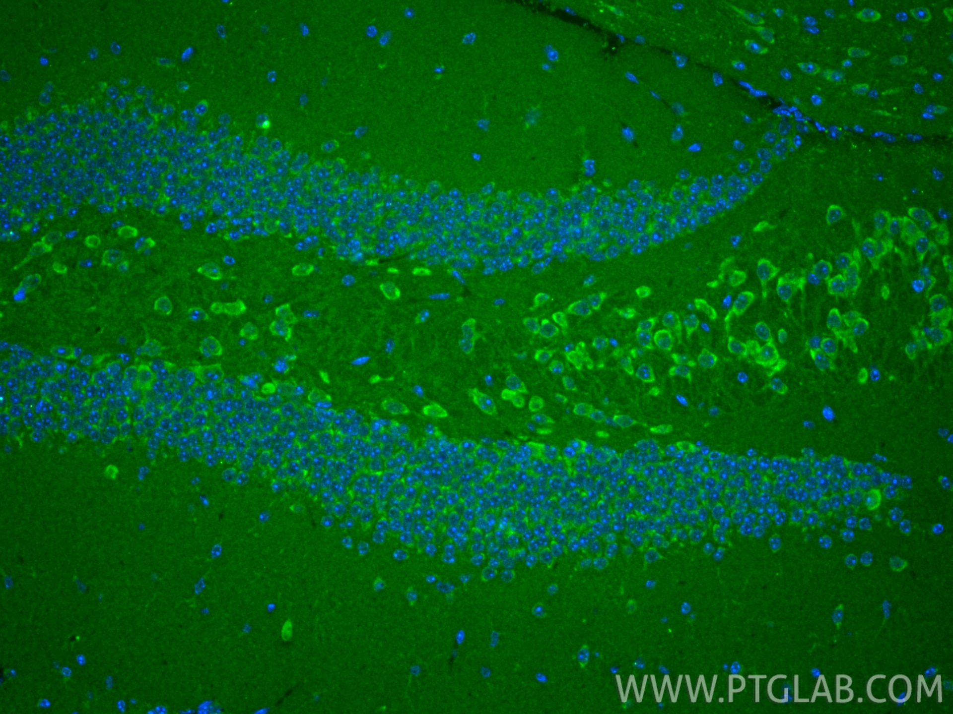 Immunofluorescence (IF) / fluorescent staining of mouse brain tissue using TRIT1 Polyclonal antibody (17141-1-AP)