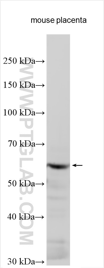 Western Blot (WB) analysis of various lysates using TRIT1 Polyclonal antibody (17141-1-AP)