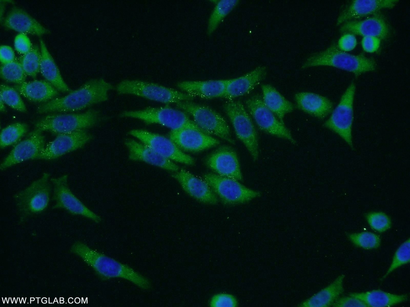 Immunofluorescence (IF) / fluorescent staining of HeLa cells using TRMT1 Polyclonal antibody (14970-1-AP)