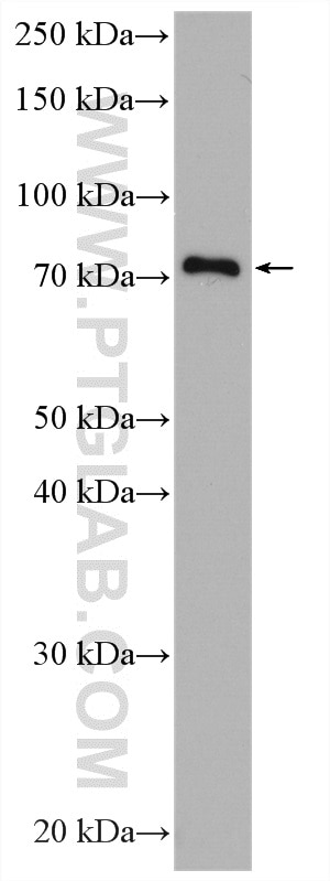 Western Blot (WB) analysis of HeLa cells using TRMT1 Polyclonal antibody (14970-1-AP)