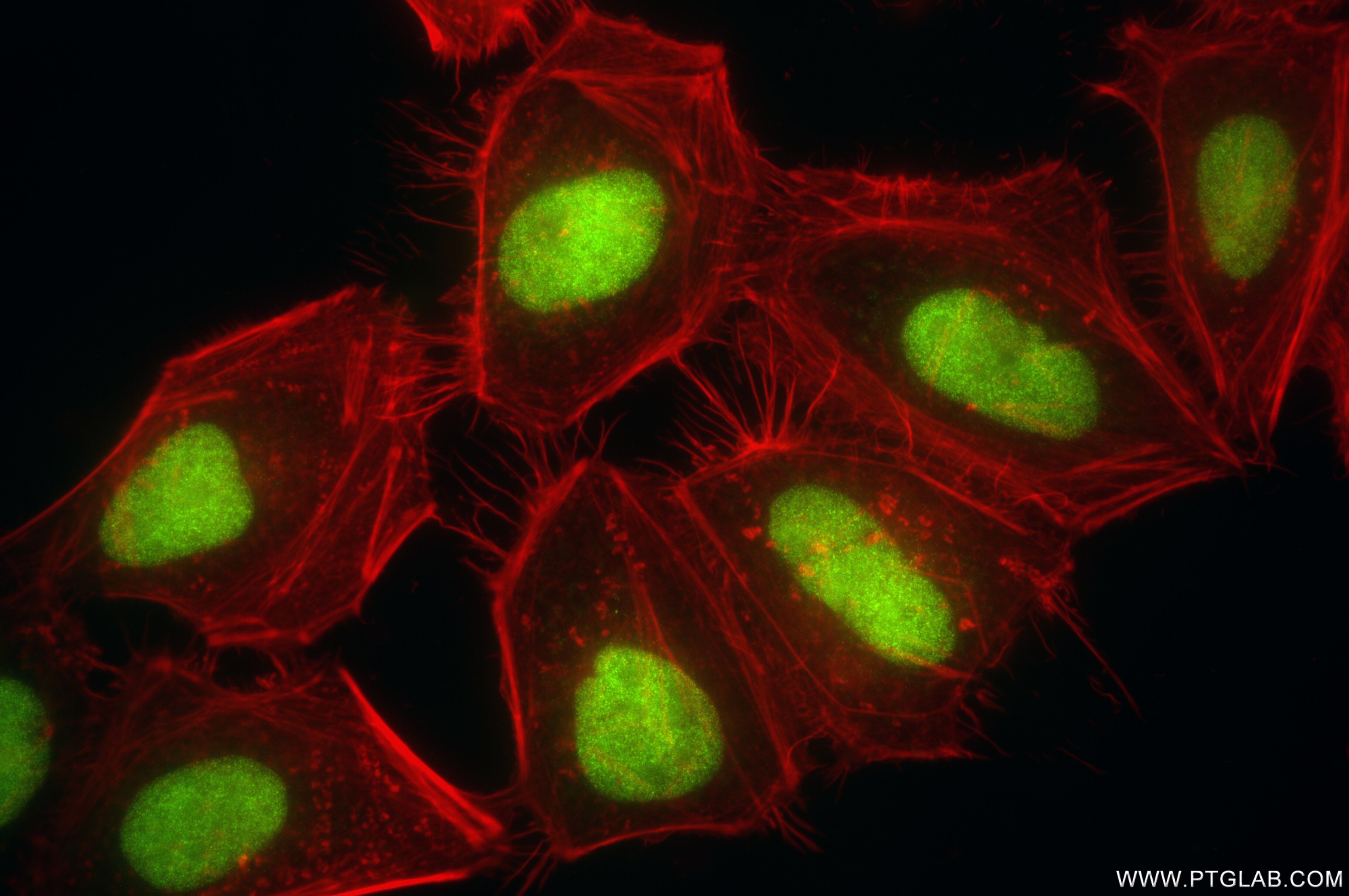 Immunofluorescence (IF) / fluorescent staining of HeLa cells using TRMT1 Recombinant antibody (85897-5-RR)