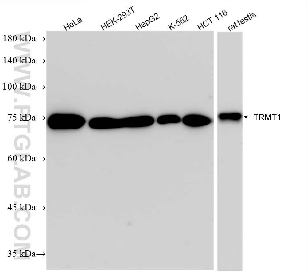 Western Blot (WB) analysis of various lysates using TRMT1 Recombinant antibody (85897-5-RR)