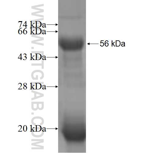 TRMT1 fusion protein Ag6837 SDS-PAGE