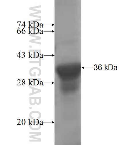 TRMT1 fusion protein Ag7112 SDS-PAGE