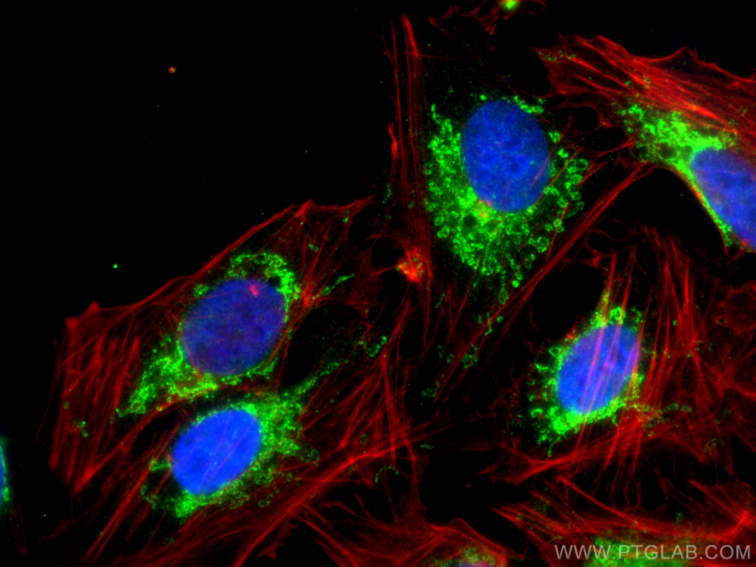 Immunofluorescence (IF) / fluorescent staining of U2OS cells using TRMT10C Polyclonal antibody (29087-1-AP)