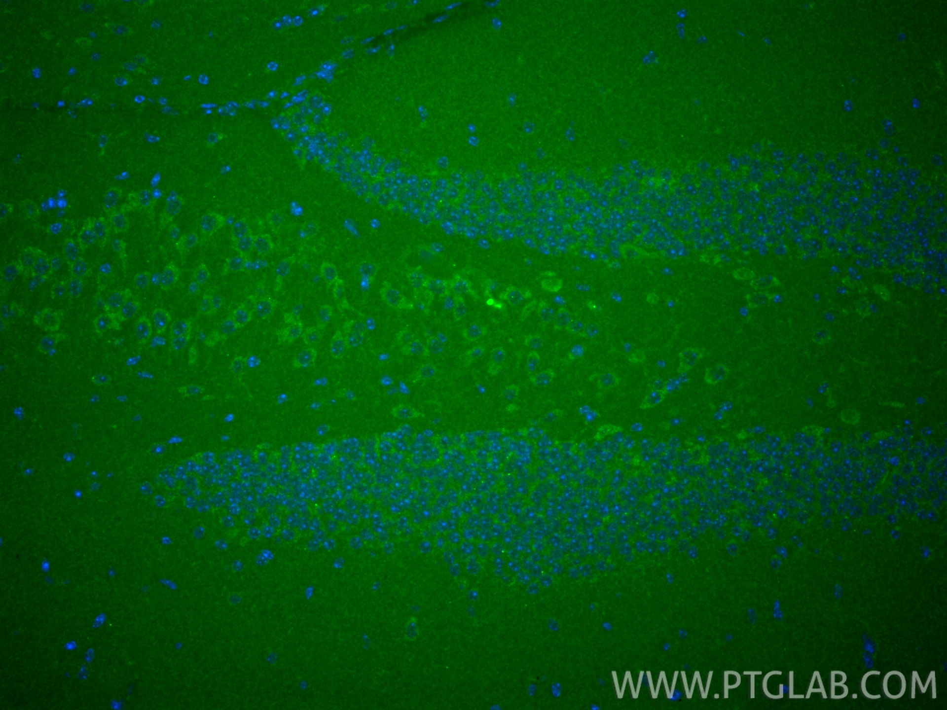 IF Staining of mouse brain using 84991-4-RR Immunofluorescence (IF) / fluorescent staining of mouse brain tissue using TRMT10C Recombinant monoclonal antibody (84991-4-RR)