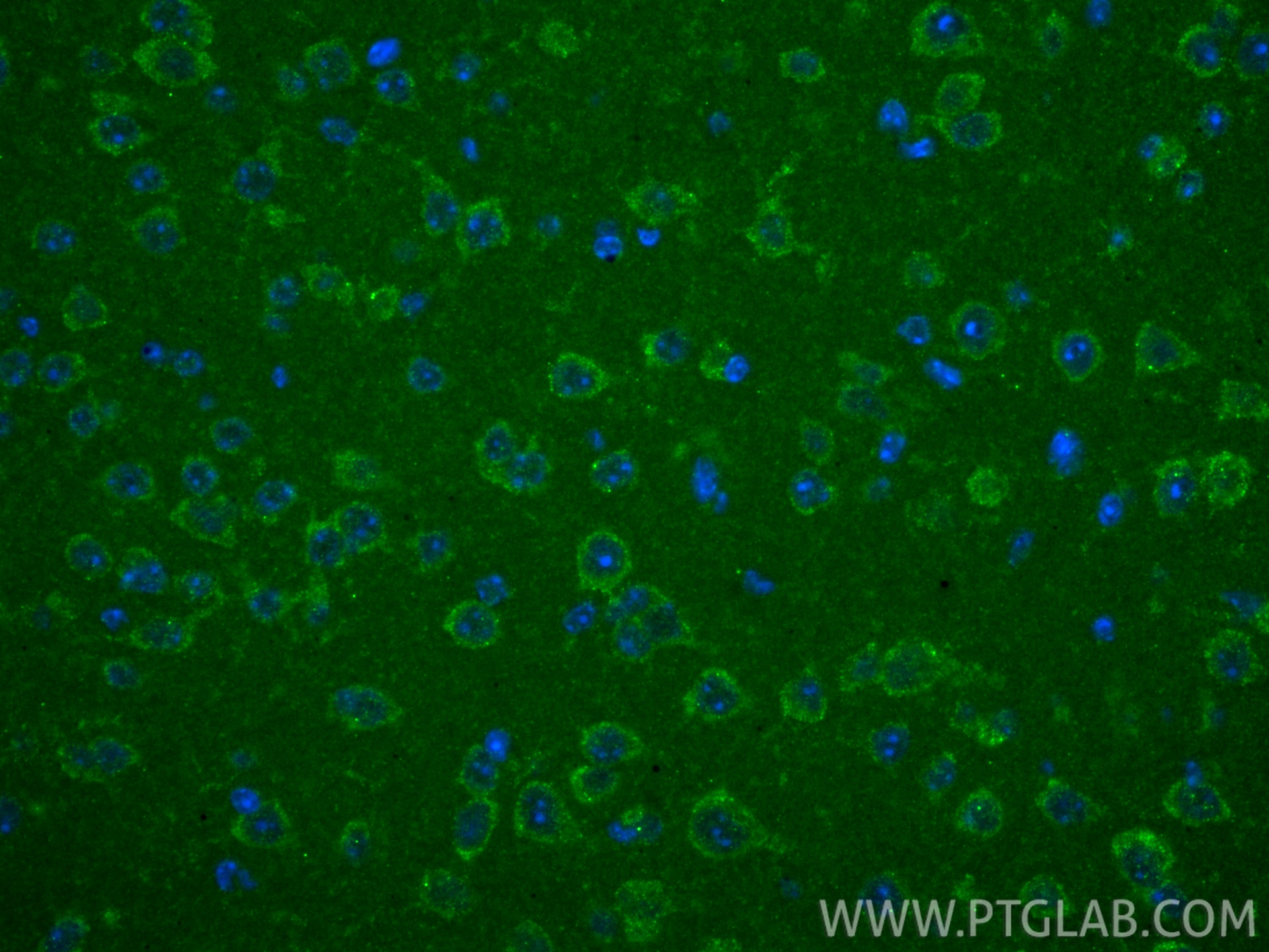 IF Staining of mouse brain using 84991-4-RR Immunofluorescence (IF) / fluorescent staining of mouse brain tissue using TRMT10C Recombinant monoclonal antibody (84991-4-RR)