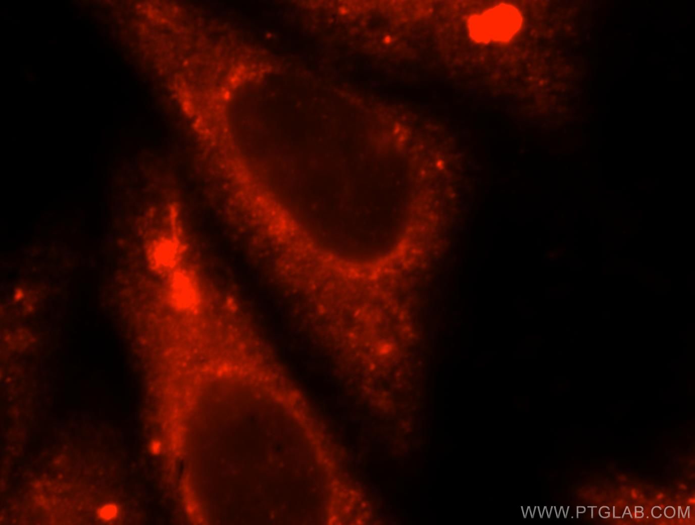 Immunofluorescence (IF) / fluorescent staining of HepG2 cells using TRMT11 Polyclonal antibody (17555-1-AP)